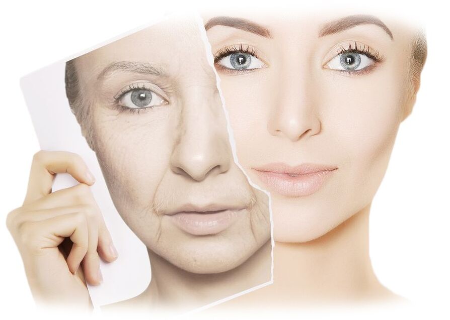 How does intenskin facial resurfacing cream work