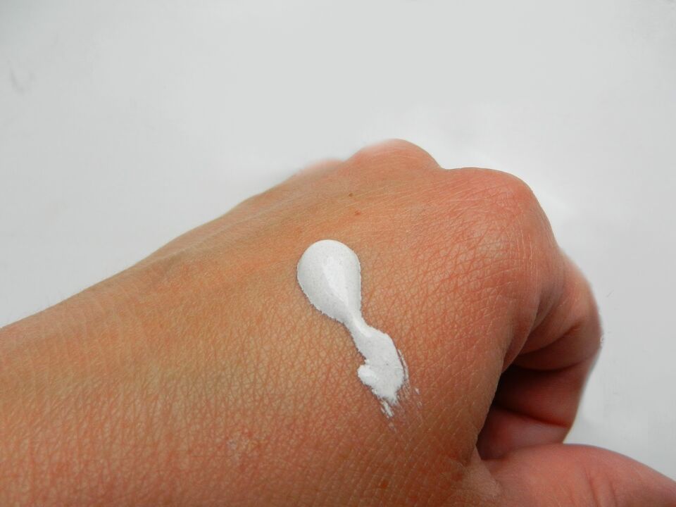 Image of intenskin cream on hand from Elizabeth's review from Dublin