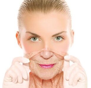 Laser rejuvenation