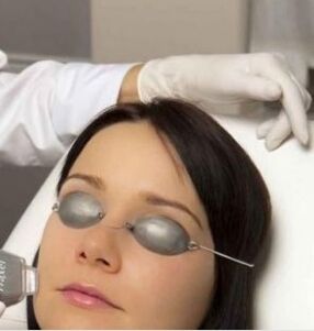 Laser rejuvenation scene