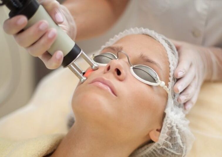 Process of scene laser rejuvenation