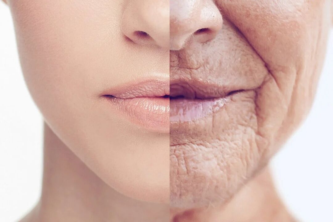 Skin deteriorates with age