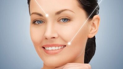 Results after micro laser skin rejuvenation