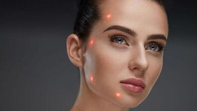 What is fractional skin rejuvenation