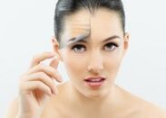 Girl after facial rejuvenation with fractional laser