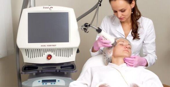 Skin rejuvenation with micro laser