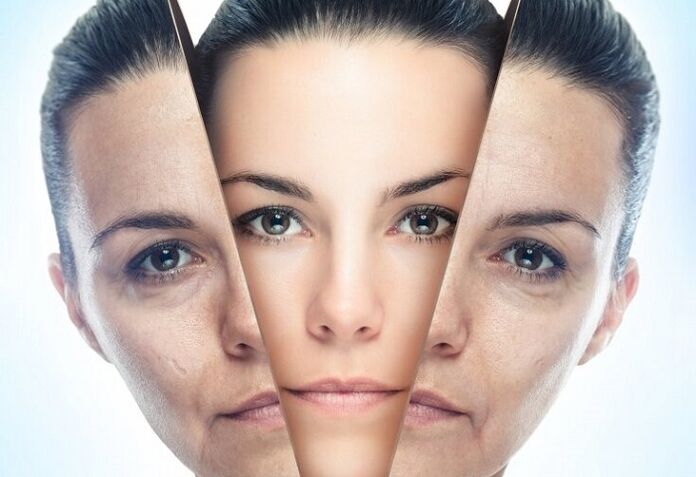 facial rejuvenation