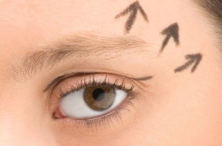Skin tightening around eyes for rejuvenation